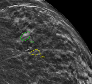 New Date Range Options
