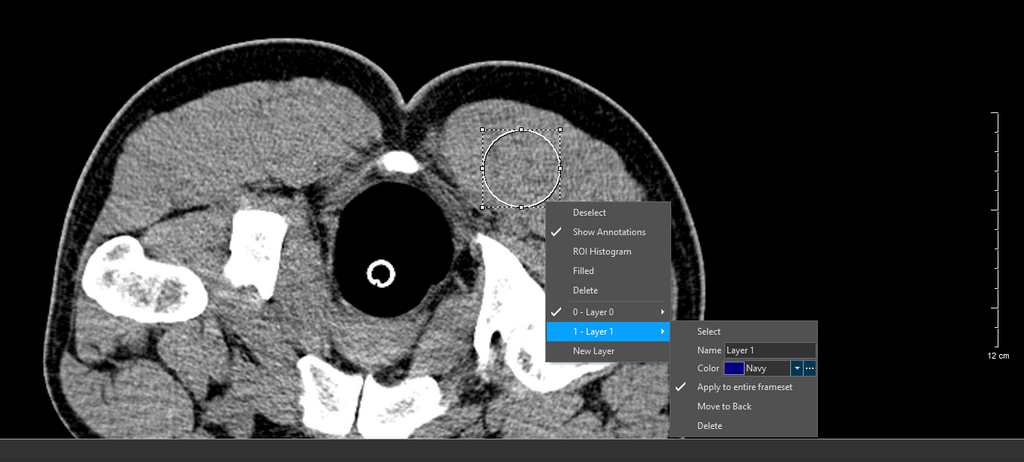 ROI Right Click Menu