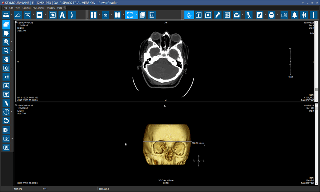 Display Layout Stack