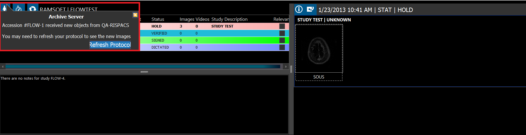 Finish Pulling From Archive
