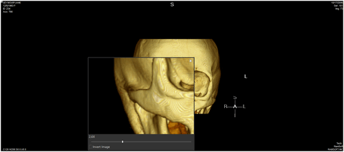 Magnifying Glass Adjust