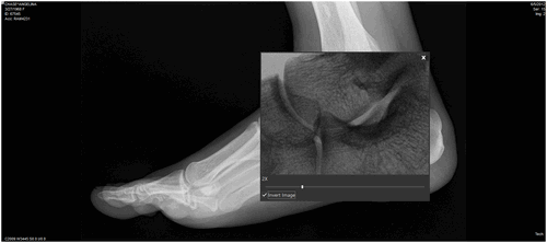 Magnifying Glass Invert