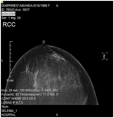 Image after rotation