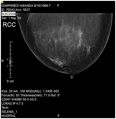 Image after counter-clockwise rotation