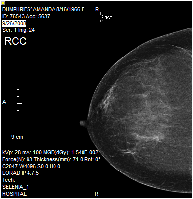 Image before rotation